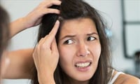 Tips to get rid of dandruff